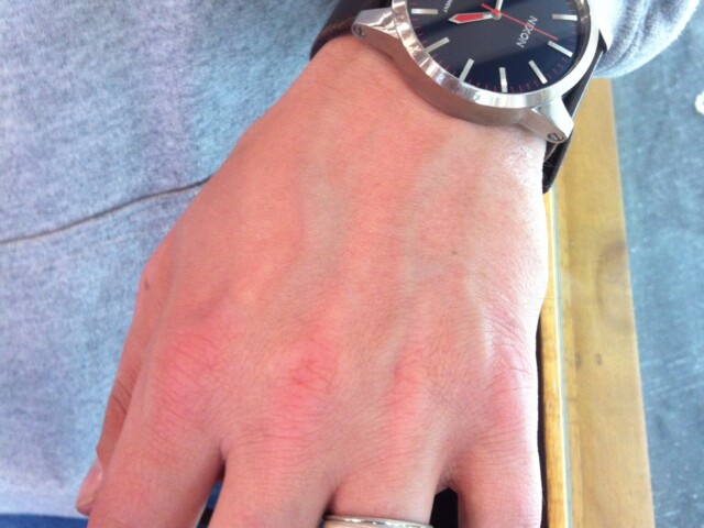 Jball trying on man rings